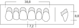 R1 - Frontzähne OK