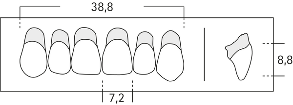 R1 - Frontzähne OK
