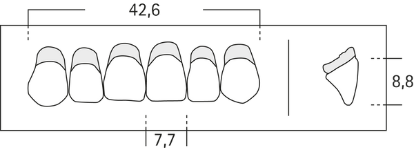 R4 - Frontzähne OK